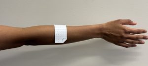 A white EMG electrode strip affixed to a person's outstretched arm